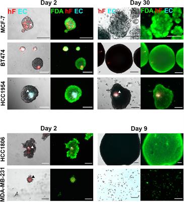 Heterotypic Tumor Spheroids in Agitation-Based Cultures: A Scaffold-Free Cell Model That Sustains Long-Term Survival of Endothelial Cells